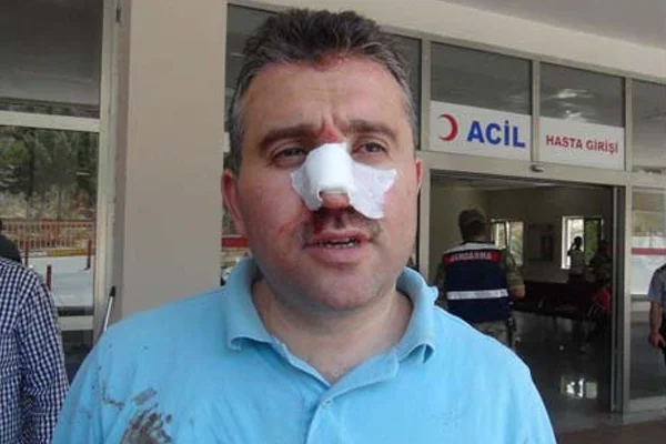 Sandık başkanını darp ettiler