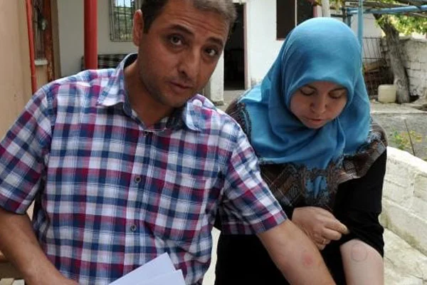 Kestikleri kurbanda tüberküloz çıktı