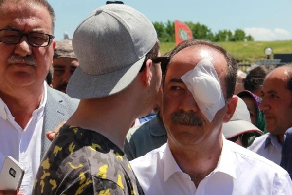 Belediye Başkanını yaralayan saldırgan tutuklandı