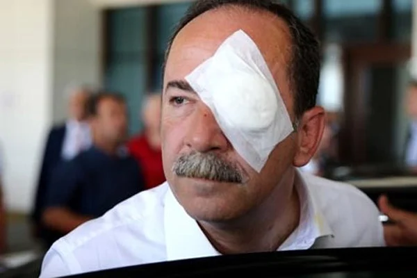 CHP'li Belediye Başkanı'na yumurtalı saldırı