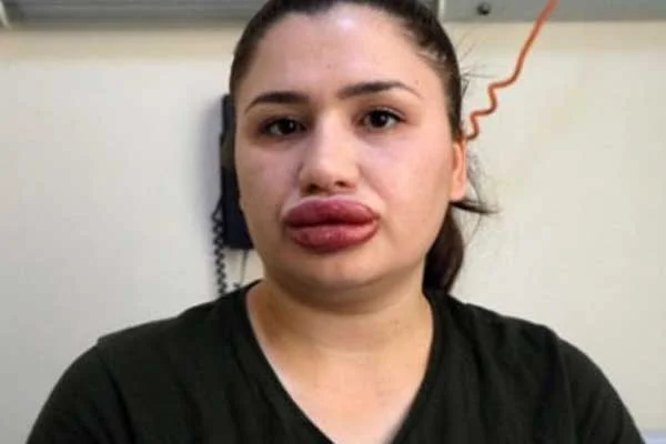 Sahte estetikçiye verilen ceza belli oldu