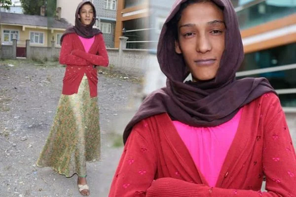 2 metrelik genç kız hastalığından kurtulmak istiyor