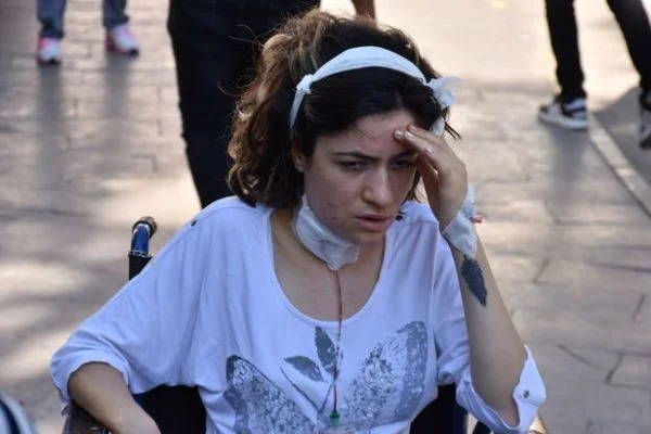 Boşanma aşamasındaki eşini darp etti