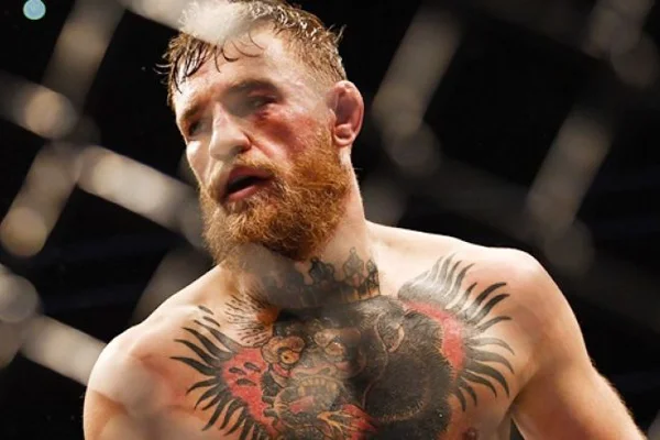 McGregor'a bir şok daha! Aldığı hasar...
