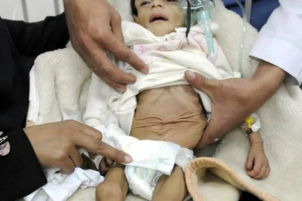 Yemen'de 10 milyon insan için kırmızı alarm