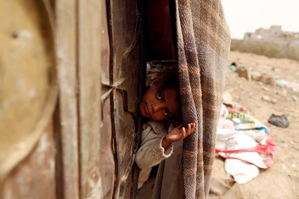 'Yemen'de kıtlığın yaratılmasında suç ortağıyız'