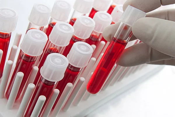 ABD'de binlerce kişiye HIV veya hepatit virüsü bulaşmış olabilir