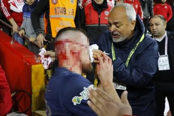 Antalyaspor-Fenerbahçe maçında talihsiz an