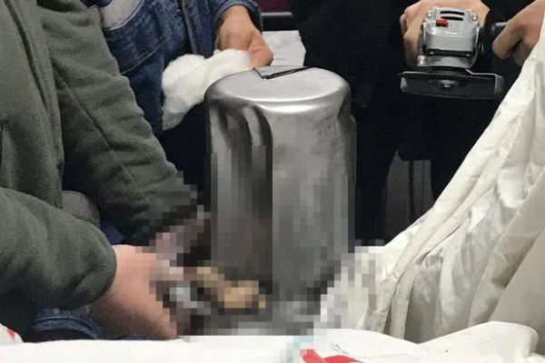 Elini pres makinesine kaptıran işçinin parmakları koptu