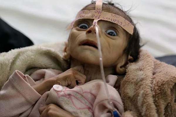 Yemen büyük bir felaketin eşiğinde