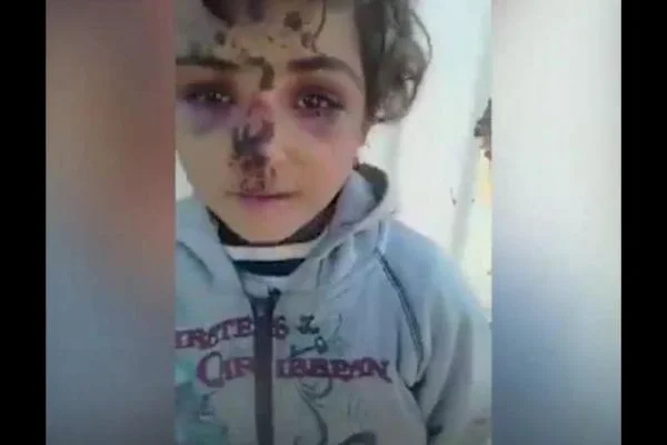 ABD öncülüğündeki koalisyon uçakları Küçük Ömer'in evini yerle bir etti