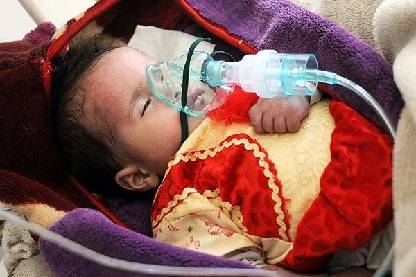 Yemen'de sağlık tesislerinin yarısı hizmet veremiyor