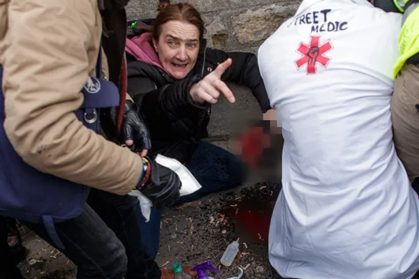 Sarı Yelekliler'in protestosu 13. haftada: Polisin attığı bomba sonucu göstericinin eli koptu