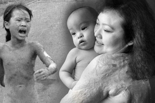 Vietnam savaşının simgesi olan küçük kız: Savaşa ihtiyacımız yok