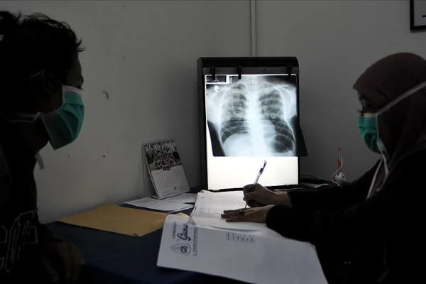 Günde 4 bin 500 kişi veremden ölüyor