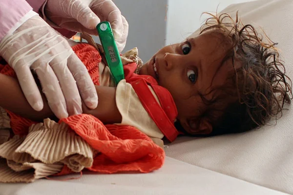 Yemen'de tehlike büyüyor: İki buçuk ayda 109 bin kolera vakası