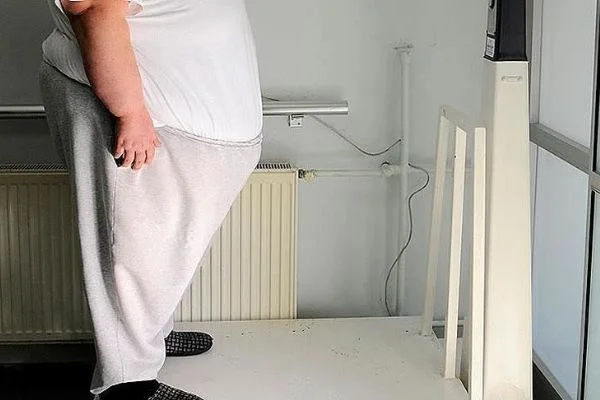 Obezitesi olanlar çareyi 6 yıl sonra hekimde arıyor