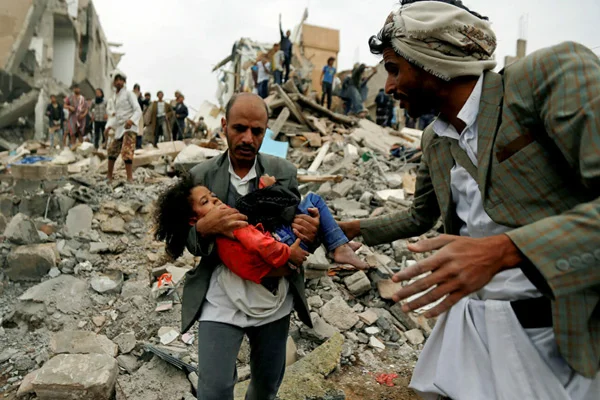 Yemen'deki iç savaşta 91 binden fazla kişi hayatını kaybetti