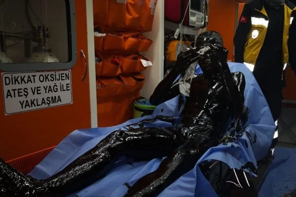 Kedi için fuel-oil kuyusuna atlayan genç: Her insanın yapması gereken hareket