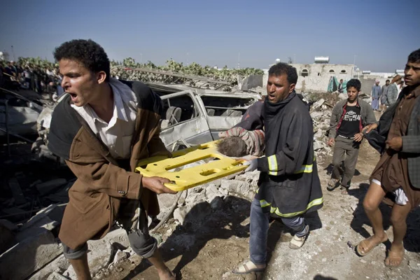 'Yemen'de sivillere yönelik şiddet tüm algıları aşıyor'