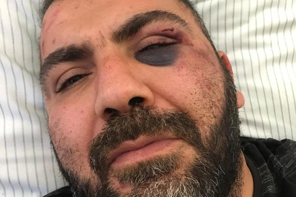 Almanya'da yaşayan Türk'e polis şiddeti iddiası