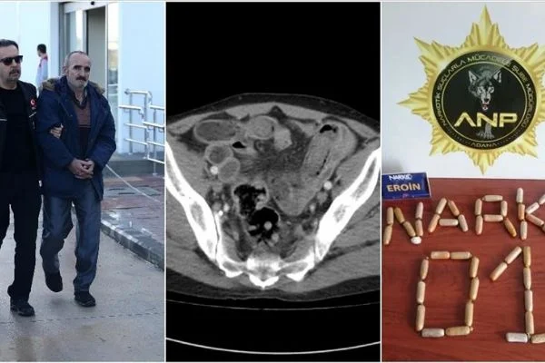 İran'dan Adana'ya midesindeki 775 gram eroinle gelmiş