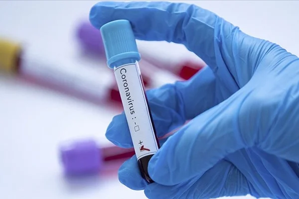Çin, yeni tip koronavirüsü 15 dakikada tespit eden kit geliştirdi