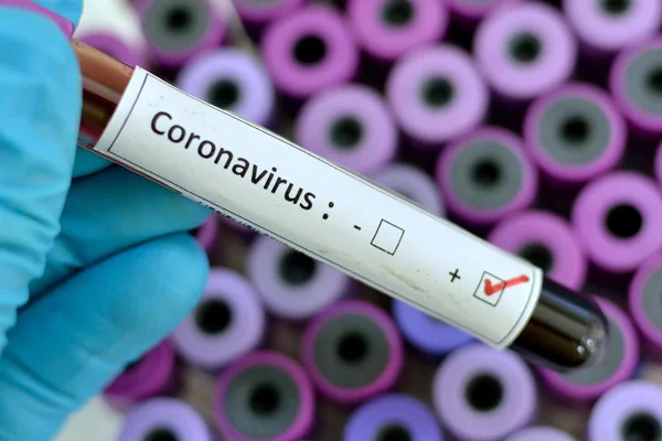 Koronavirüs 1 günde 109 can aldı: Ölü sayısı 2 bin 347'ye yükseldi