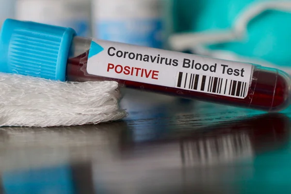 ABD'de Kovid-19 araştırması: Koronavirüs, SARS ve MERS kadar ölümcül değil