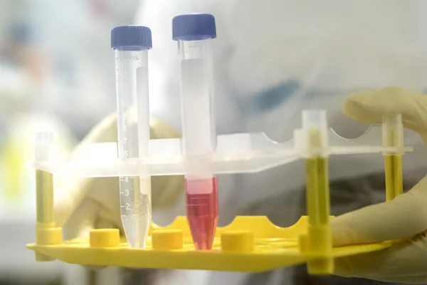 ABD'de yaşayan iki Türk, koronavirüs test kiti üretti