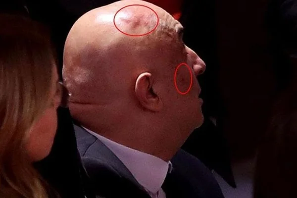 Engin Özkoç'un son hali ortaya çıktı