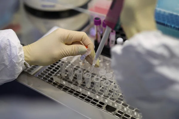 İngiltere'den ''test'' kararı: Halka dağıtılacak
