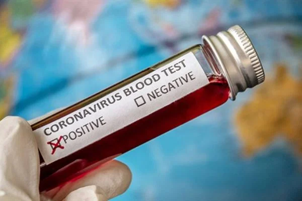 Koronavirüs ne zaman bitecek? Koronavirüs salgını için tarih verildi