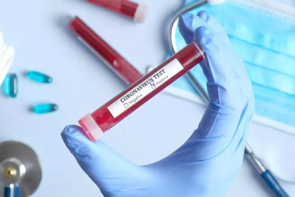 Koronavirüs testi nerede nasıl yapılır? Koronavirüs testi yapan hastaneler hangileri