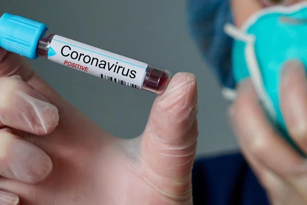 Dünya genelinde koronavirüs vaka sayısı 2,5 milyonu aştı