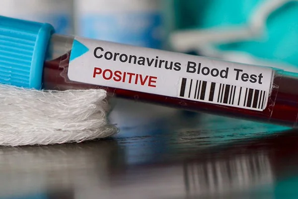 Koronavirüs vakası 1 milyon 100 bini aştı