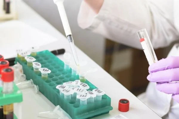 Oxford'lu bilim insanları, 20 dakikada sonuç verecek test geliştirdi
