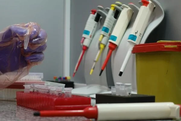 Kovid-19'da hata payını en aza indiren test kiti sağlıkçılara uygulanıyor
