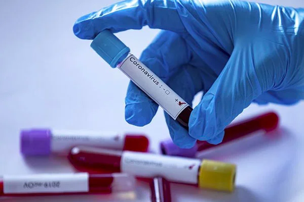Tüm dünya o doktoru konuşuyor! 'Hızlı normalleşme daha fazla ölüm ve acıya neden olabilir'