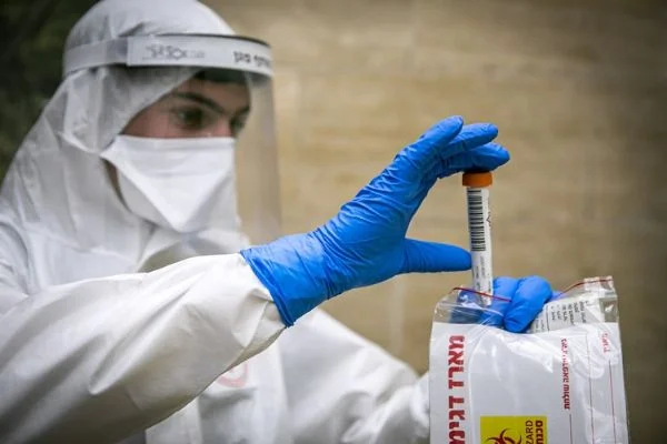 Antikor testinin özelliği nedir?