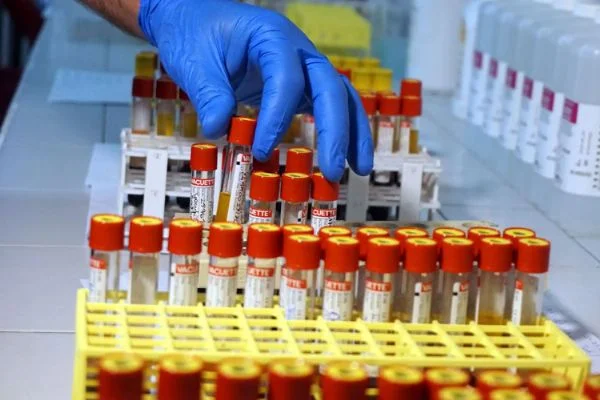Antikor testleri başladı: 20 Haziran'da sonuçlanacak