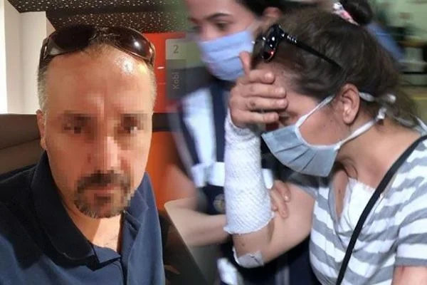 Eski sevgilisinin yüzüne kezzaplı saldırı düzenleyen kadın tutuklandı