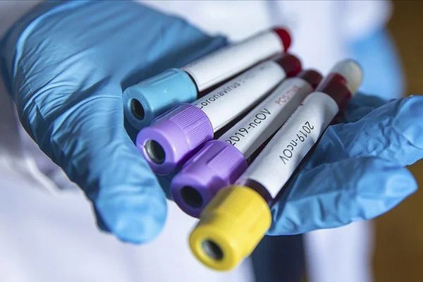 İcra katibinin Kovid-19 testi pozitif çıktı