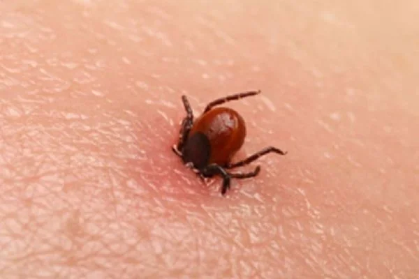 Keneye karşı önemli uyarı: Beyaz giysiler tercih edilmeli