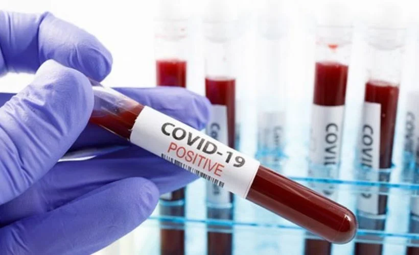 Almanya'da Covid-19 test sonuçlarının gecikmesi büyük yankı uyandırdı