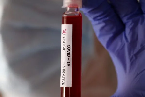 Koronavirüs Güney Afrika Cumhuriyeti'nde AIDS ile mücadeleyi olumsuz etkiliyor