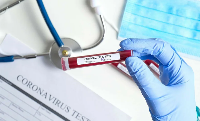 Koronavirüs test kılavuzu hakkında kafa karıştıran iddia!