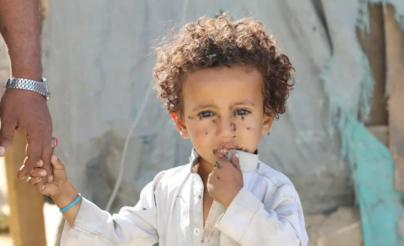 Yemen'de sona eren yardımlardan 9 milyon kişi zarar gördü
