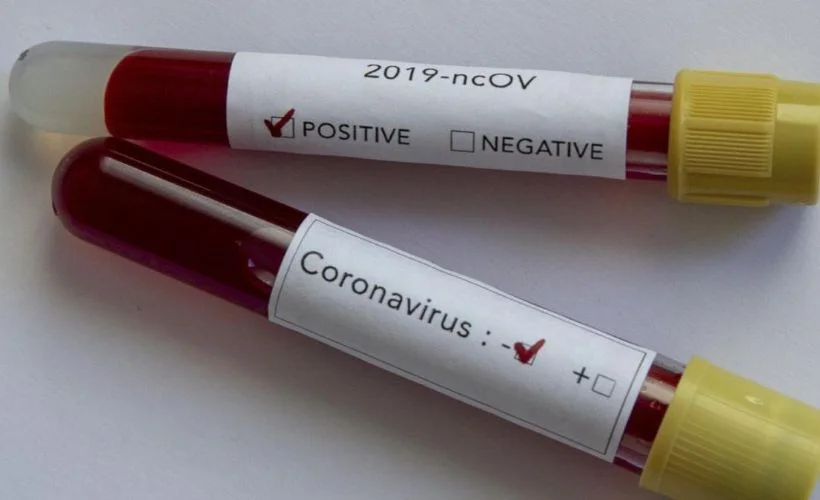 ABD'de koronavirüs salgınında hayatını kaybedenlerin sayısı 228 bin 423'e çıktı