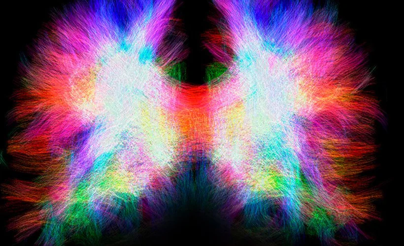 Beynin köprüsü 'Corpus Callosum' hakkında ne biliyoruz?